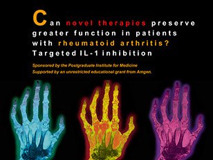 Novel Therapies in RA Educational Presentation | Medical Meeting PPT Slides